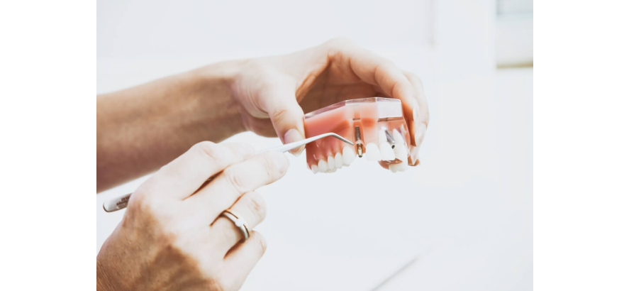 Nicotine Pouches and Your Gums